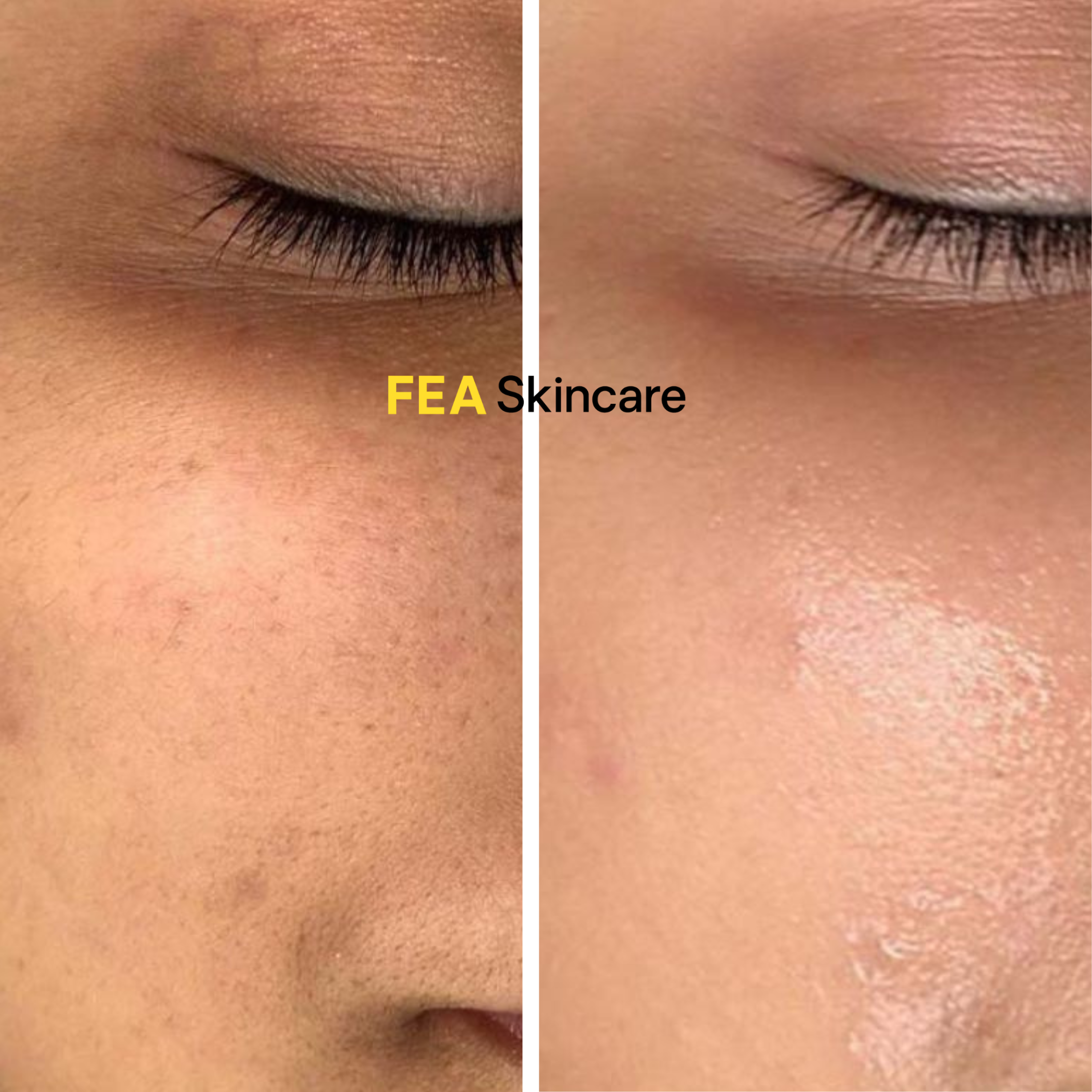 Aloe Moisture Mousse