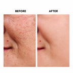 Dark Spot Corrector