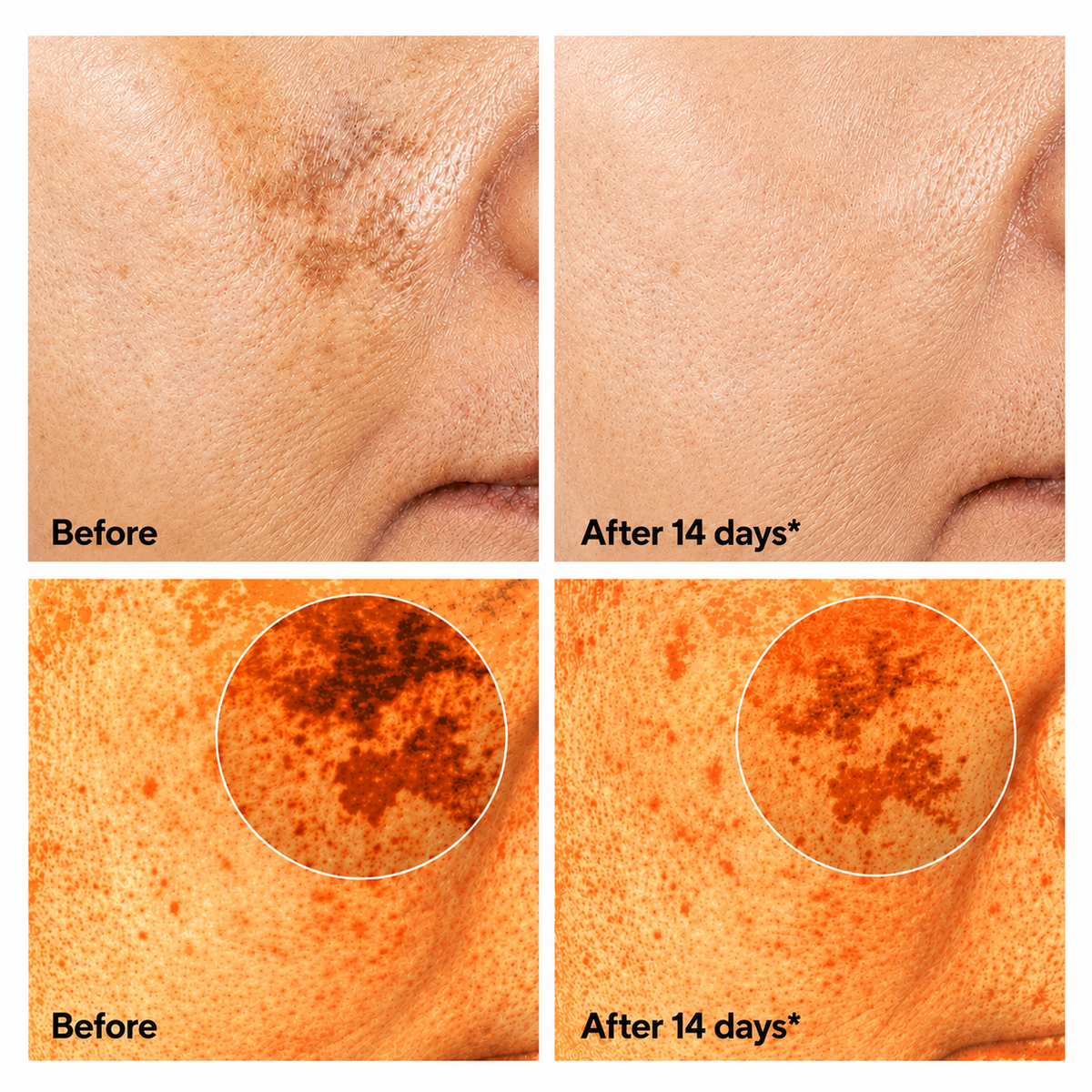 Dark Spot Corrector