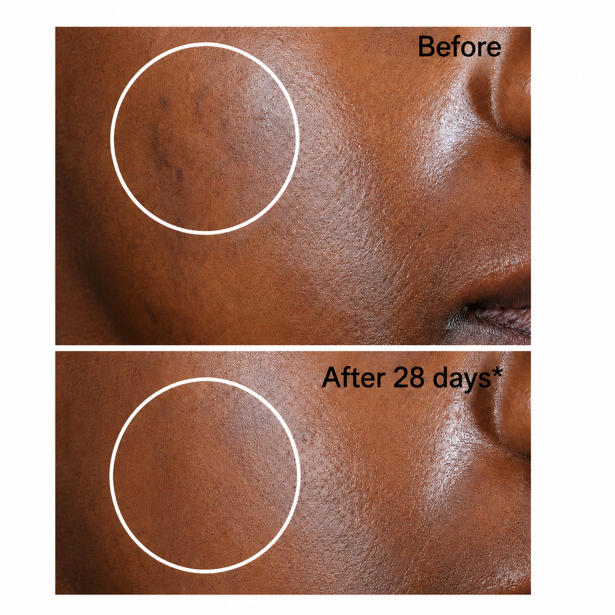 Dark Spot Corrector