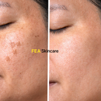 Dark Spot Corrector
