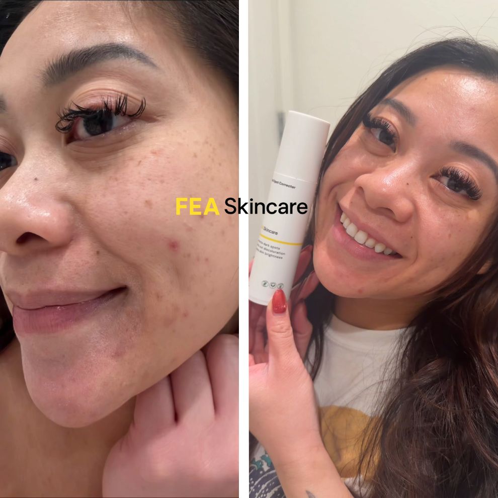 Dark Spot Corrector
