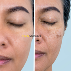 Dark Spot Corrector