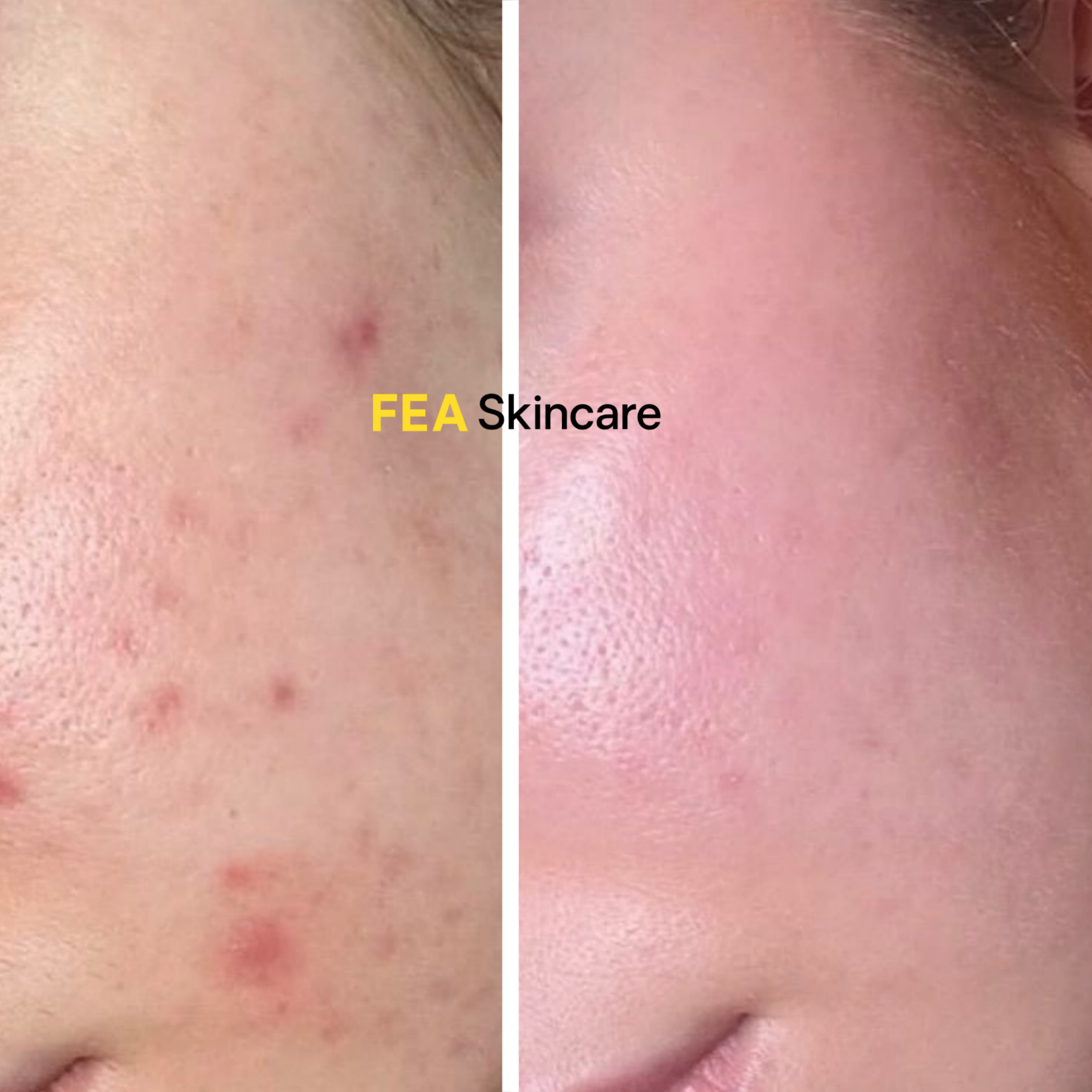 Skin Hydration Toner