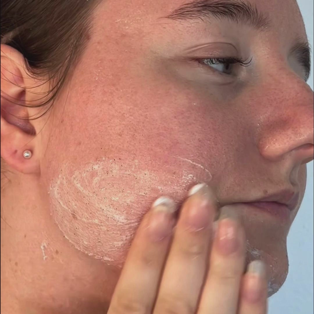 Acne Face and Body Scrub